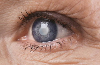 Diabetic Retinopathy