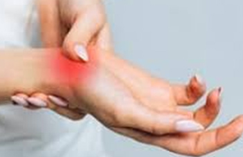 carpel-tunnel-syndrome